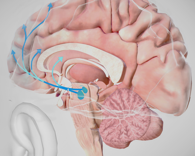 경두개직류자극 tDCS